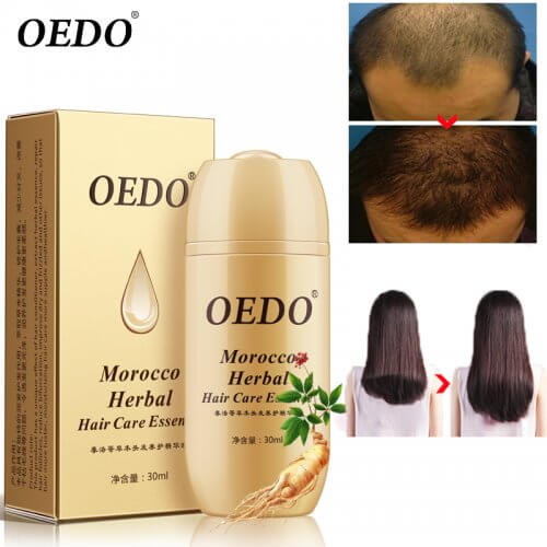 Лосион за растеж и сгъстяване на коса OEDO
